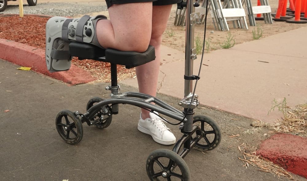 A person with a leg cast is using a knee scooter, likely rented to aid mobility, outside. They are wearing a white sneaker on the other foot and navigating smoothly on a paved surface near a sidewalk. Orange cones and ladders are visible in the background.
